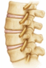 Degenerative Osteoarthritis